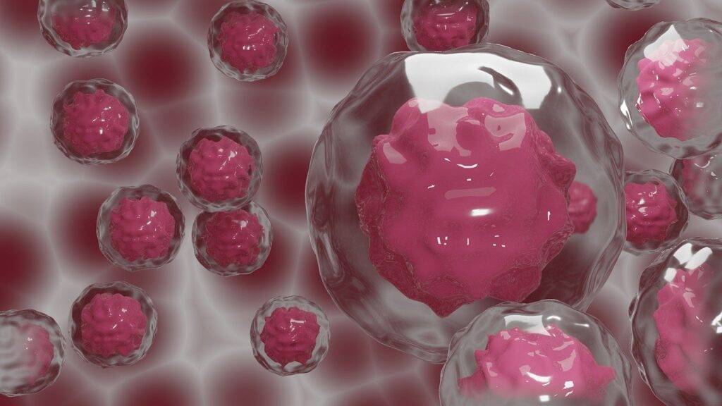 Can Intermittent fasting prevent Cancer?