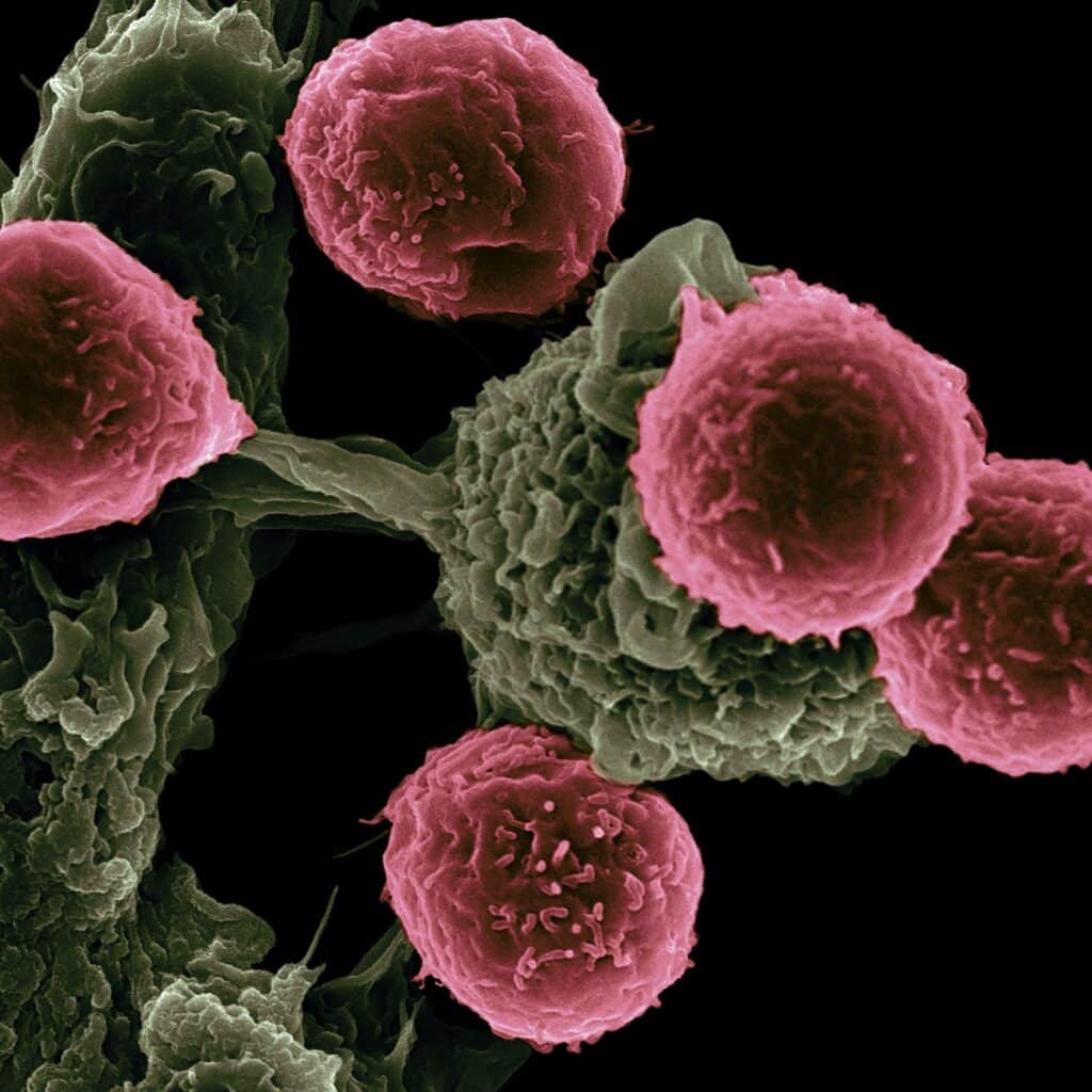 Can Ketogenic diet prevent Cancer