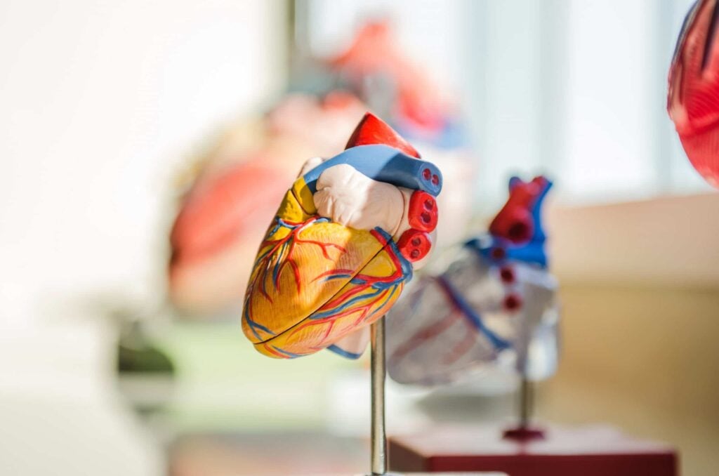 bariatric surgery - reduces risks of heart diseases