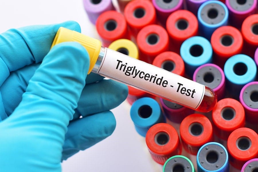 High Triglycerides Diet Food List