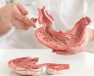 7 Foods to Avoid With an Ulcer