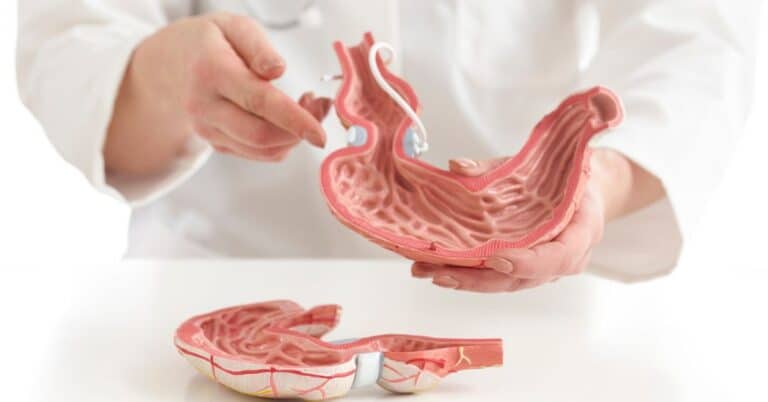 Foods to Avoid with an Ulcer