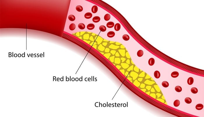 7 Day Meal Plan to Lower Cholesterol